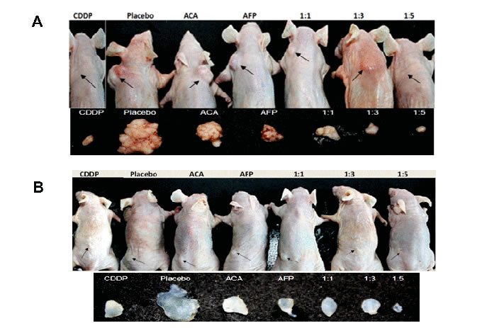 Tumour reduction effects of various rhAFP/ACA treatment regimes on