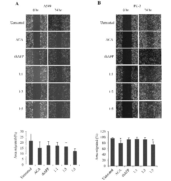 The inhibition effects of ACA stand alone, rhAFP stand alone, and rhAFP/ACA complex on cell migration.