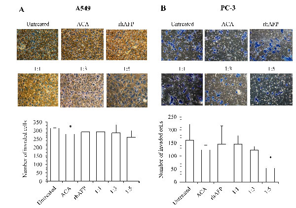 The inhibition effects of ACA stand alone, rhAFP stand alone, and rhAFP/ACA complex on cell invasion.