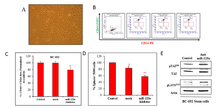 Targeting miR-125a in primary breast cancer cells.