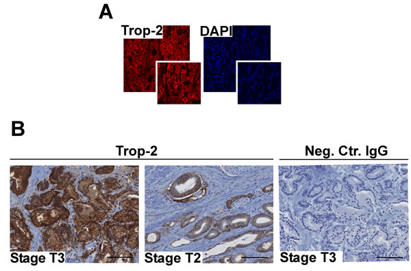 Trop-2 localization and expression in PCa.