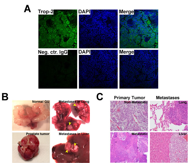 Analysis of Trop-2 expression in metastatic PCa from TRAMP mice.