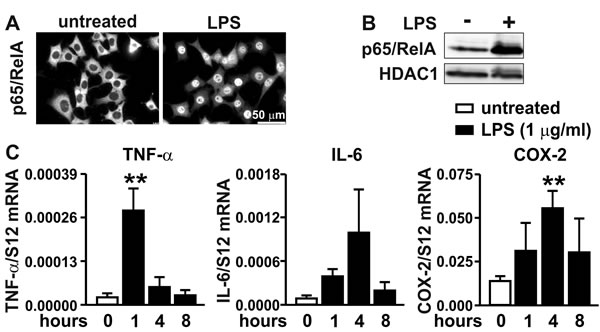 Inflammatory response of MC-38 cells.