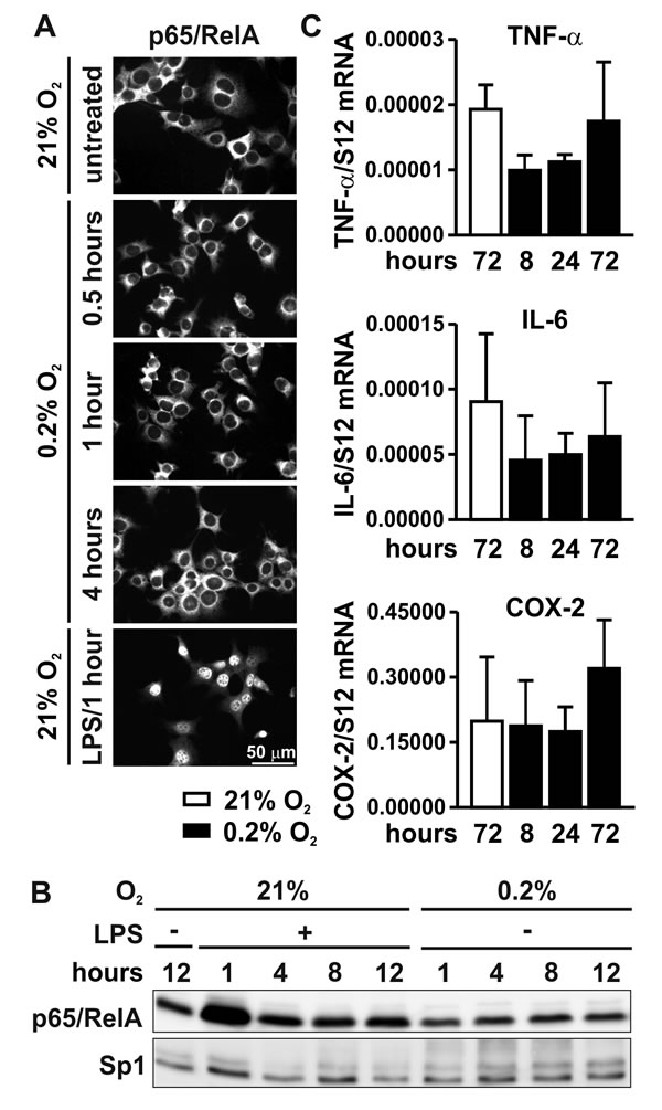 NF-&#x3ba;B signaling under hypoxic conditions.