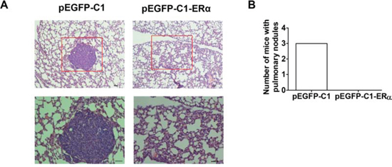 ER&#x03B1; expression reduces the metastasis of BT549 cells.