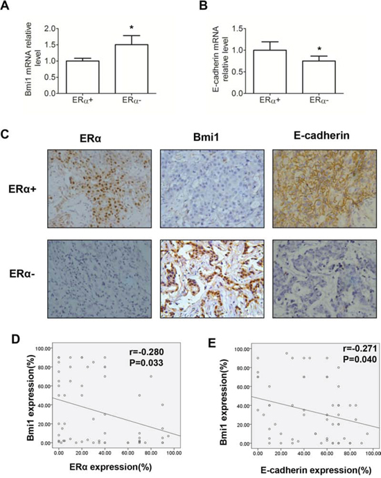 Association of Bmi1 and E-cadherin expression in 58 human breast cancer tissues.