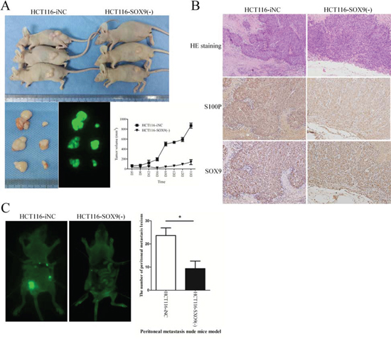 SOX9 enhances tumorigenesis and metastasis in vivo.