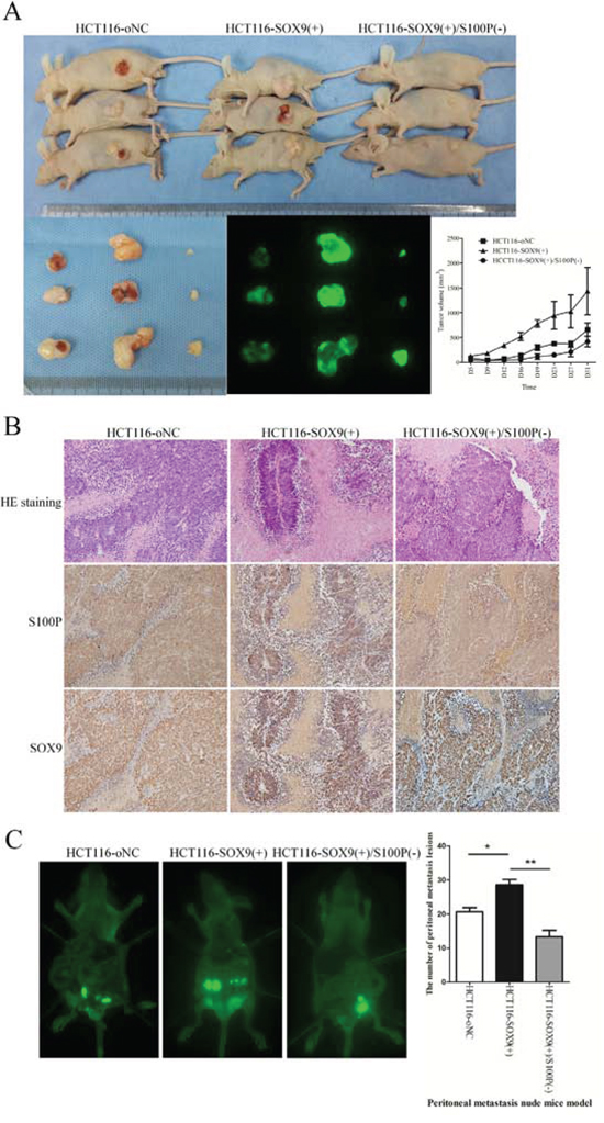 S100P is essential for SOX9 induction of tumorigenesis and metastasis in vivo.