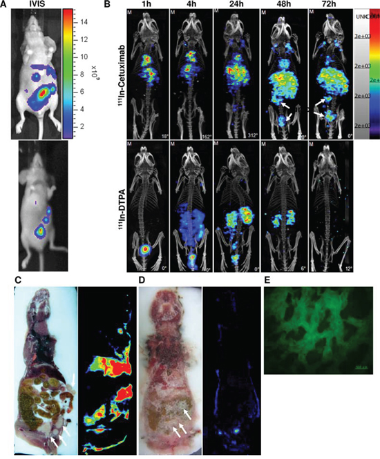 HCT-116/Luc metastatic colorectal tumors (white arrow indicates abdominal colorectal tumors) IVIS images.