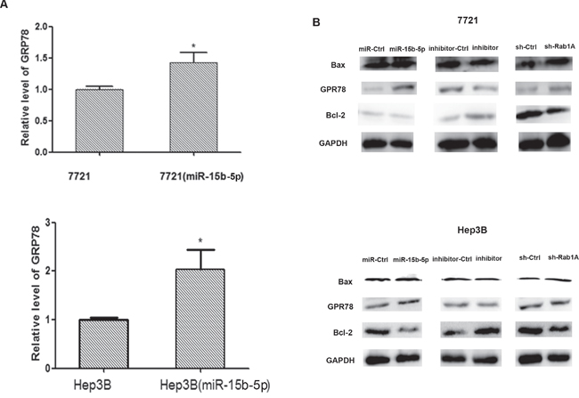 Overexpression of miR-15b-5p induces endoplasmic reticulum stress and results apoptotic death in human hepatocellular carcinoma.