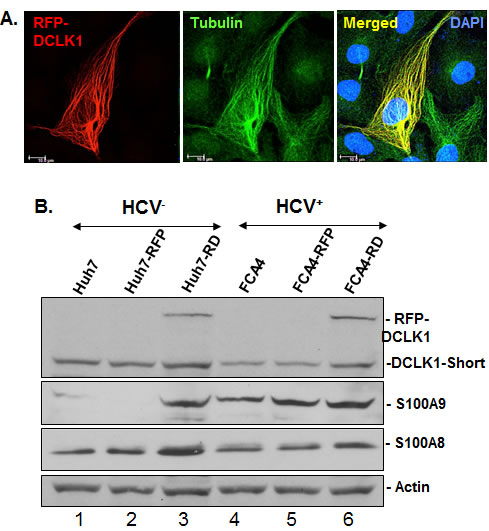 DCLK1 overexpression and HCV induces calprotectin subunit S100A9.