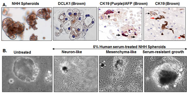 Cellular plasticity and transforming potential of normal human hepatocytes (NHHs) expressing endogenous DCLK1.