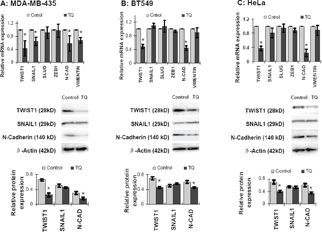 Effects of Thymoquinone (TQ) on mRNA and protein level expression of EMT associated proteins in cancer cells.