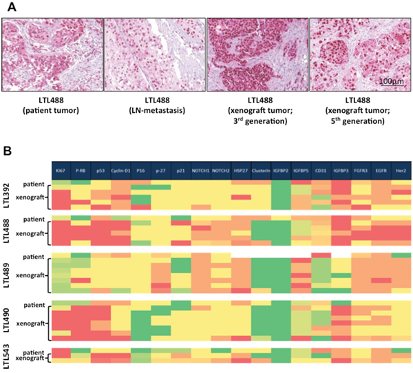 Retention of morphological characteristics and protein expression in xenografts.