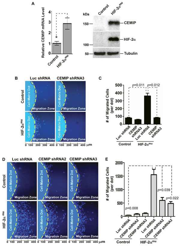 HIF-2&#x03B1; leads to increased cell migration that is dependent on upregulated CEMIP.