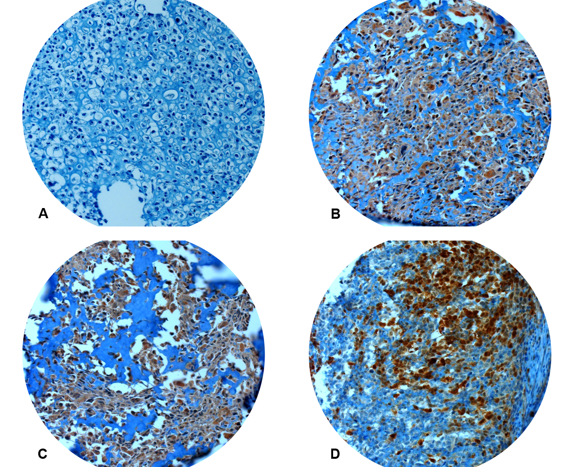 Immunhistochemistry for CRIP1.