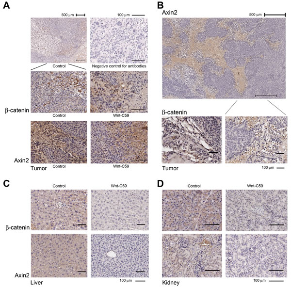 Wnt/&#x3b2;-catenin pathway is activated in the niche of growing tumors.