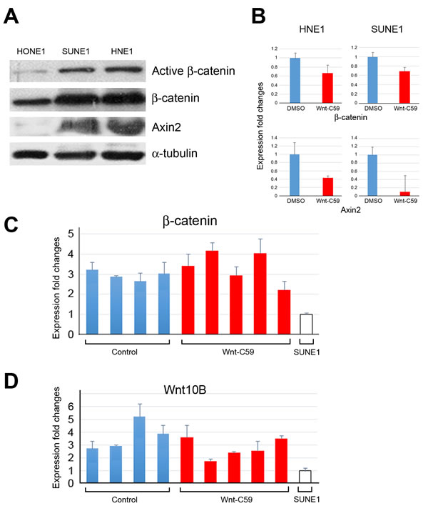 Wnt/&#x3b2;-catenin activities in HNE1 cells, SUNE1 cells, and tumor tissues.