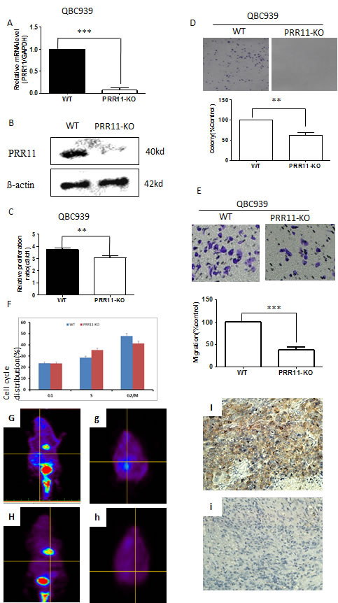 PRR11 knockdown inhibits cell proliferation and cell migration