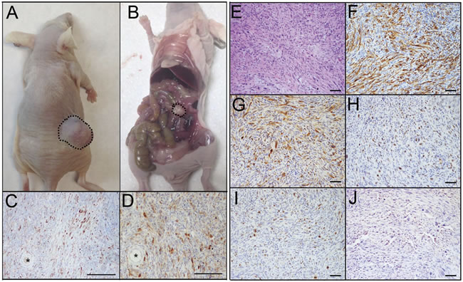 PTENshRNA/p53R273H MOE form high-grade carcinomas with reduced i.p.