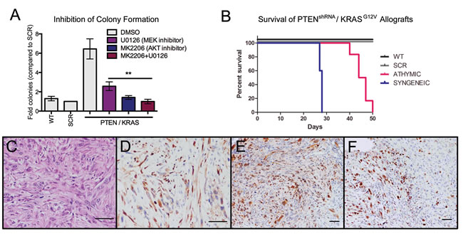 MOE cells as preclinical models for therapeutic development.