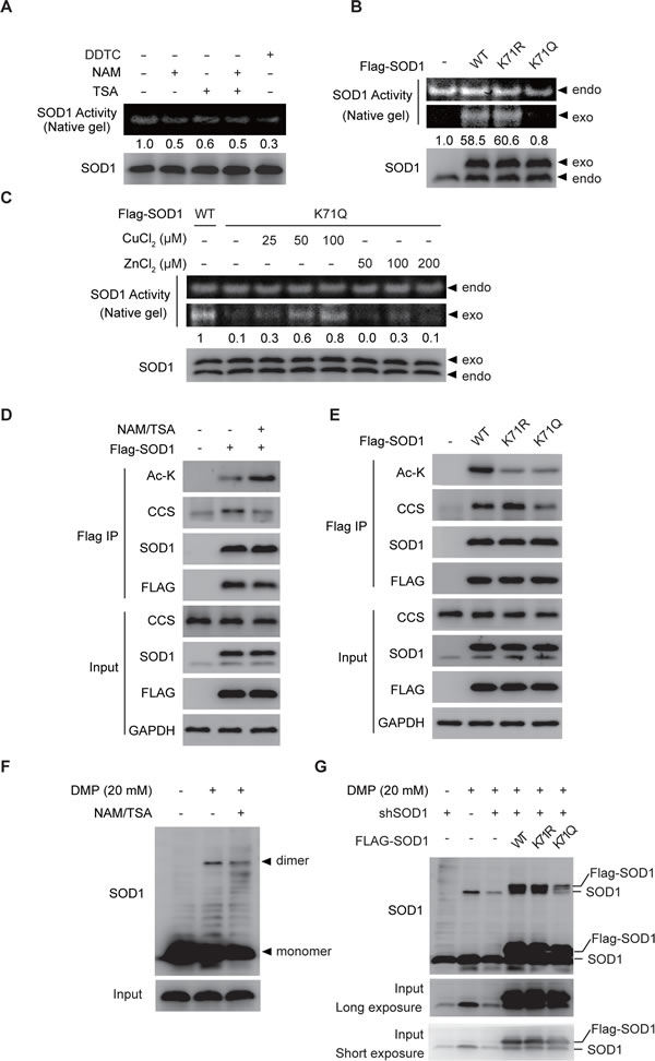 SOD1 acetylation inactivates SOD1.