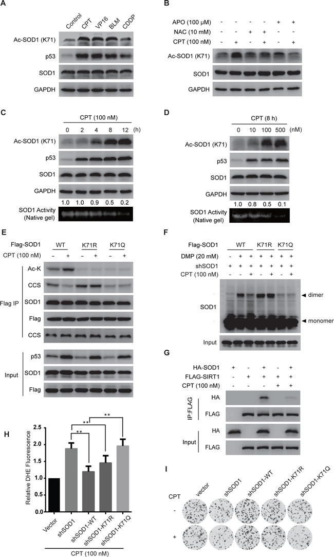 Genotoxic agents promote SOD1 acetylation and inactivate SOD1.