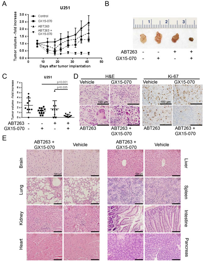 Combined treatment with ABT263 and GX15-070 results in an enhanced inhibition of tumor growth
