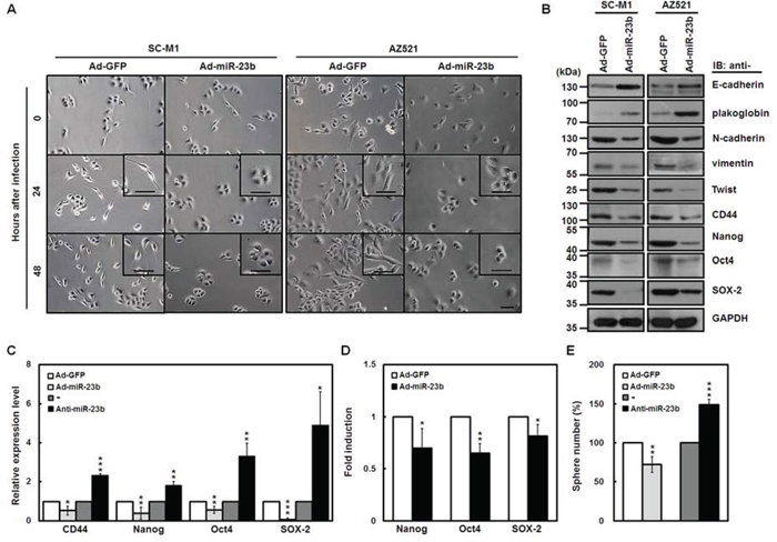 miR-23b suppresses EMT and sphere formation ability of gastric cancer cells.