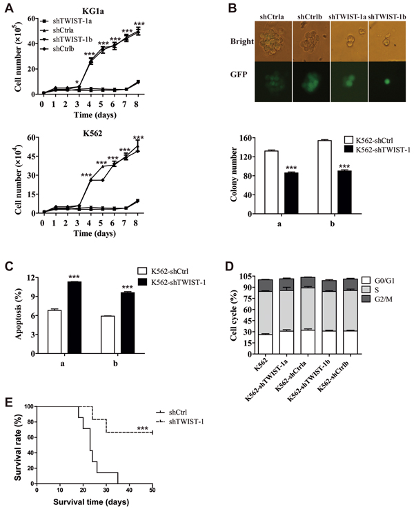 shRNA-mediated silencing of TWIST-1 expression inhibits the tumor growth.