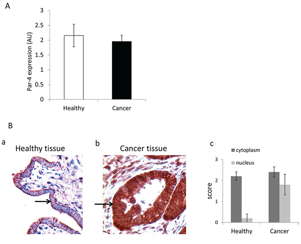 Presence of PAR-4 in healthy and cancer tissues.
