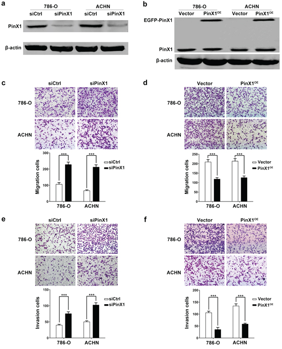 PinX1 inhibits migration and invasion of ccRCC cells.