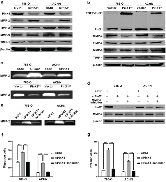 PinX1 inhibits migration and invasion of ccRCC cells by suppressing MMP-2 expression and activity.