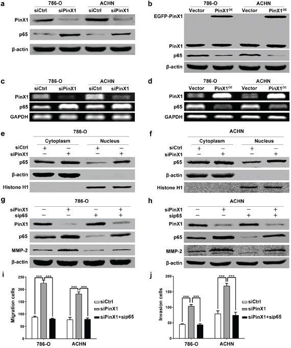 PinX1 inhibits migration and invasion of ccRCC cells by suppressing MMP-2 expression via NF-&#x03BA;B-dependent transcription.