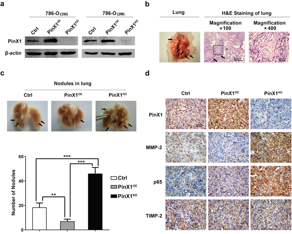 PinX1 suppress ccRCC metastasis in vivo.