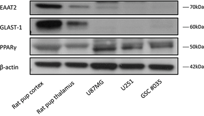 Representative blots showing EAAT2, GLAST-1, PPAR&#x03B3; and &#x03B2;-actin expression in rat cortex, thalamus and glioma cells.