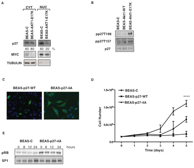 Mutant AKT1-E17K promotes cytoplasmic delocalization of p27.
