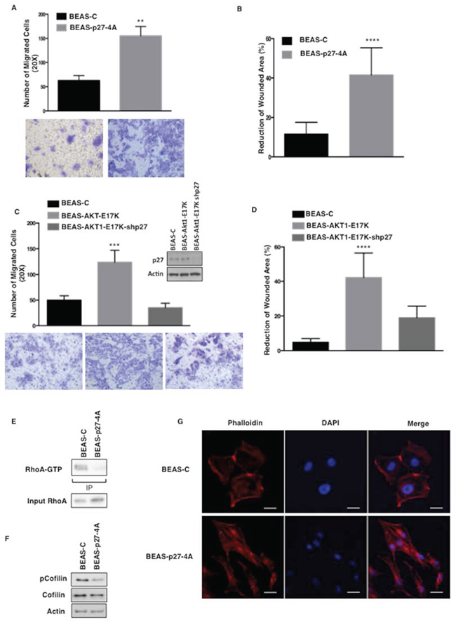 Mutant AKT1-E17K increases cell motility through cytoplasmic delocalization of p27.