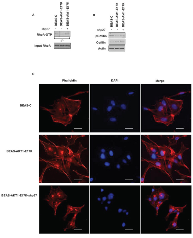 p27 is required for motility induced by mutant AKT1-E17K.