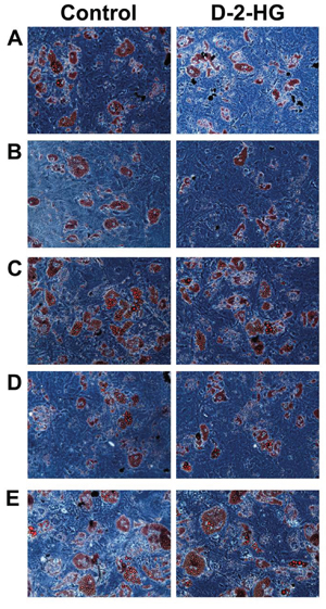 Oil-red-O staining of 5 MSCs to determine the effect of D-2-HG on the ability to differentiate into adipocytes.