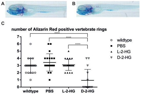 Bone development in zebrafish embryos in the presence of D-2-HG.