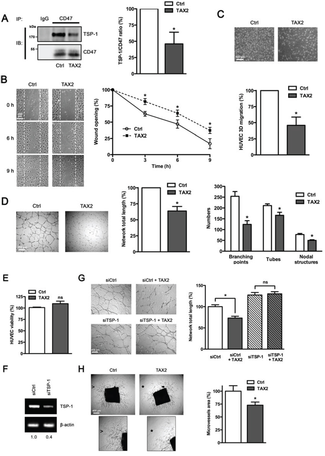 TAX2 peptide impairs endothelial cell migration and inhibits angiogenesis in vitro and ex vivo.