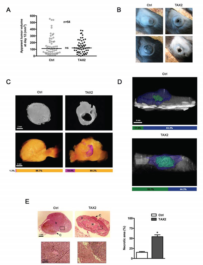 TAX2 induces central tumor necrosis in a mouse melanoma allograft model.
