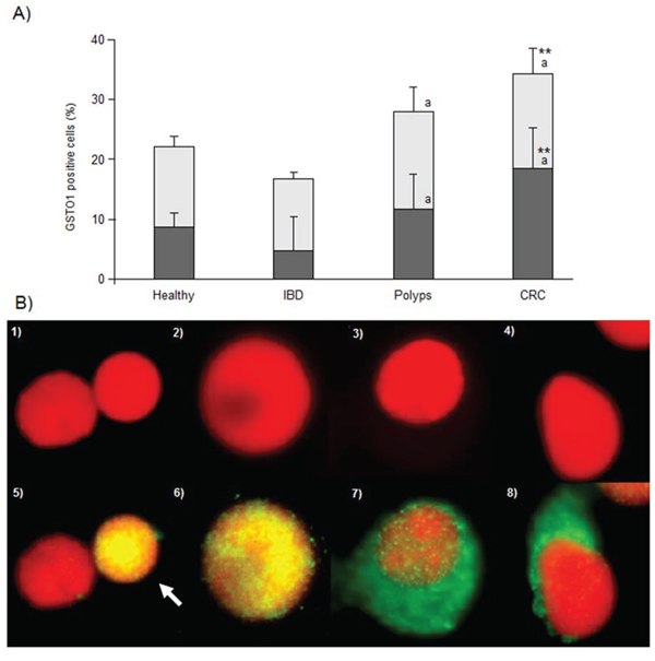 GSTO1 immunofluorescence results.