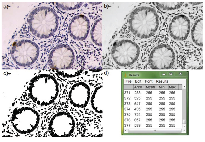 Image analysis for &#x03B3;H2AX quantification in tissue.