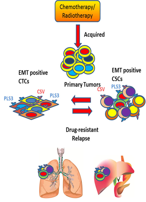 Understanding the dynamic equilibrium between EMT positive CTCs and CSCs to define tumor relapse.