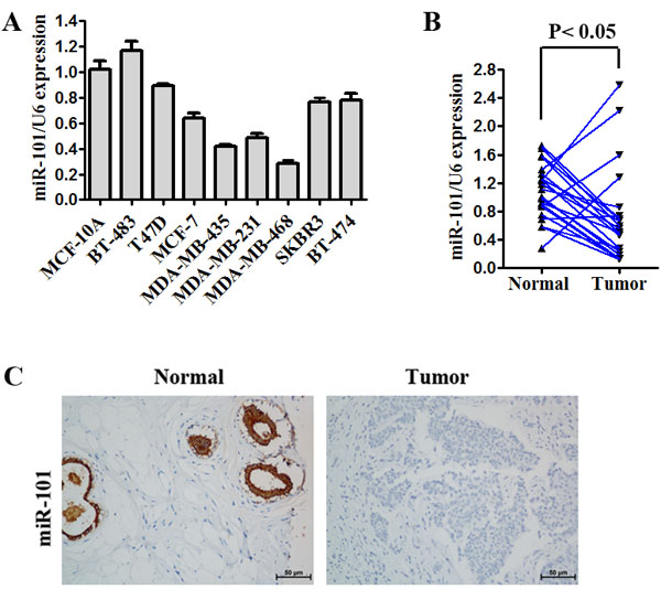 Expression of miR-101 is decreased in TNBC.