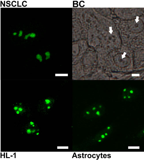 Subcellular localization of PGAM with the use of antibody directed to C-terminal peptide of the protein.