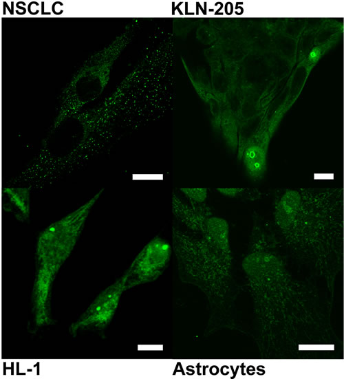 Localization of PGAM with the use of antibody against the C-terminal peptide in neoplastically transformed (NSCLC, KLN-205) and non-malignant (HL-1 cardiomiocytes, astrocytes) cells cultured in serum-free media.