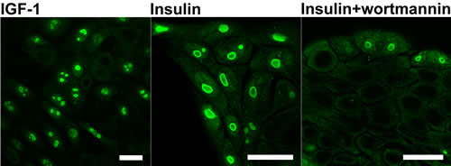 Localization of PGAM in KLN-205 cells in different culture conditions.